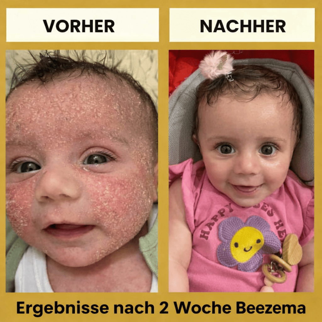 Beezema Honey Baby Ekzem-Beruhigungscreme